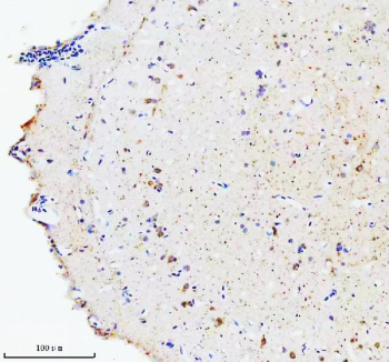Zebrafish Hsc70 Antibody Brain IHC. Immunohistochemistry staining of FFPE zebrafish brain tissue with Zebrafish Hsc70 antibody, HRP secondary and DAB substrate. HIER: boil tissue sections in pH8 EDTA for 20 min and allow to cool before testing.