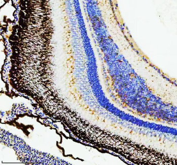 Zebrafish Hsc70 Antibody Retina IHC. Immunohistochemistry staining of FFPE zebrafish retina tissue with Zebrafish Hsc70 antibody, HRP secondary and DAB substrate. HIER: boil tissue sections in pH8 EDTA for 20 min and allow to cool before testing.
