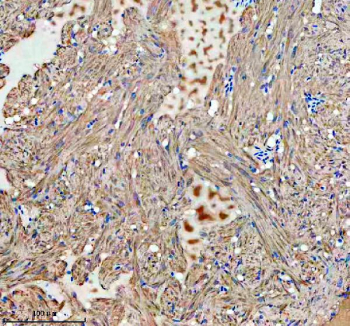 Zebrafish Gbf1 Antibody Heart IHC. Immunohistochemistry staining of FFPE zebrafish heart tissue with Zebrafish Gbf1 antibody. HIER: boil tissue sections in pH8 EDTA for 20 min and allow to cool before testing.