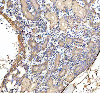 Zebrafish Gbf1 Antibody Kidney IHC. Immunohistochemistry staining of FFPE zebrafish kidney tissue with Zebrafish Gbf1 antibody. HIER: boil tissue sections in pH8 EDTA for 20 min and allow to cool before testing.