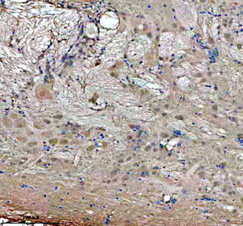 Zebrafish Gbf1 Antibody Brain IHC. Immunohistochemistry staining of FFPE zebrafish brain tissue with Zebrafish Gbf1 antibody. HIER: boil tissue sections in pH8 EDTA for 20 min and allow to cool before testing.