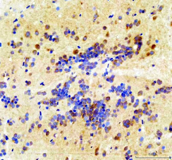 Zebrafish Csnk2b Antibody Brain IHC. Immunohistochemistry staining of FFPE zebrafish brain tissue with Zebrafish Csnk2b antibody, HRP secondary and DAB substrate. HIER: boil tissue sections in pH8 EDTA for 20 min and allow to cool before testing.