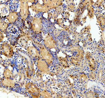Zebrafish Csnk2b Antibody Kidney IHC. Immunohistochemistry staining of FFPE zebrafish kidney tissue with Zebrafish Csnk2b antibody, HRP secondary and DAB substrate. HIER: boil tissue sections in pH8 EDTA for 20 min and allow to cool before testing.