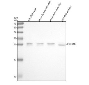 Zebrafish Csnk2b Antibody WB. Western blot analysis of Csnk2b protein using Zebrafish Csnk2b antibody and 1) zebrafish head, 2) whole female zebrafish, 3) whole male zebrafish and 4) zebrafish embryo tissue lysate. Predicted molecular weight ~25 kDa.
