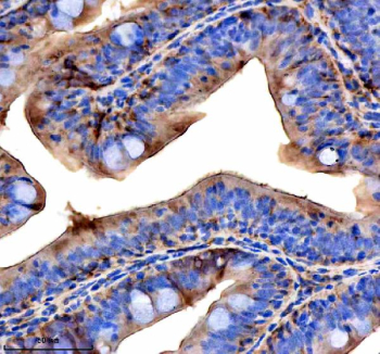 Zebrafish Vps53 Antibody Colon IHC. Immunohistochemical analysis of Vps53 protein using Vps53 antibody and paraffin-embedded zebrafish colon tissue. HIER: boil tissue sections in pH8 EDTA for 20 min and allow to cool before testing.