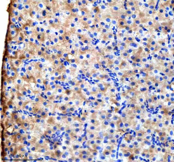 Zebrafish Vps53 Antibody Liver IHC. Immunohistochemical analysis of Vps53 protein using Vps53 antibody and paraffin-embedded zebrafish liver tissue. HIER: boil tissue sections in pH8 EDTA for 20 min and allow to cool before testing.
