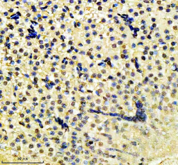 Zebrafish H2ax Antibody Liver IHC. Immunohistochemistry staining of FFPE zebrafish liver tissue with Zebrafish H2ax antibody, HRP secondary and DAB substrate. HIER: boil tissue sections in pH8 EDTA for 20 min and allow to cool before testing.