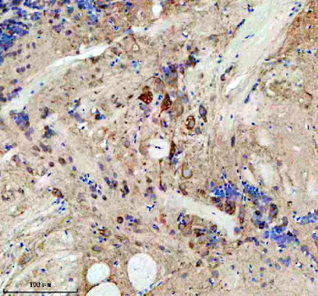 Zebrafish Eif3a Antibody Brain IHC. Immunohistochemistry staining of FFPE zebrafish brain tissue with Zebrafish Eif3a antibody, HRP secondary and DAB substrate. HIER: boil tissue sections in pH8 EDTA for 20 min and allow to cool before testing.