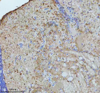 Zebrafish Gnaq Antibody Brain IHC. Immunohistochemistry staining of FFPE zebrafish brain tissue with Zebrafish Gnaq antibody, HRP secondary and DAB substrate. HIER: boil tissue sections in pH8 EDTA for 20 min and allow to cool before testing.