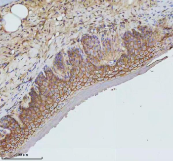 Zebrafish Gnaq Antibody Esophagus IHC. Immunohistochemistry staining of FFPE zebrafish esophagus tissue with Zebrafish Gnaq antibody, HRP secondary and DAB substrate. HIER: boil tissue sections in pH8 EDTA for 20 min and allow to cool before testing.