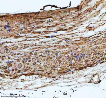Zebrafish Atp6v1a Antibody Spinal Cord IHC. Immunohistochemical analysis of Atp6v1a protein using Zebrafish Atp6v1a antibody and paraffin-embedded zebrafish spinal cord tissue. HIER: boil tissue sections in pH8 EDTA for 20 min and allow to cool before testing.