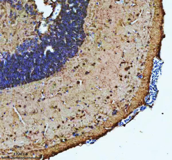 Zebrafish Atp6v1a Antibody Brain IHC. Immunohistochemical analysis of Atp6v1a protein using Zebrafish Atp6v1a antibody and paraffin-embedded zebrafish brain tissue. HIER: boil tissue sections in pH8 EDTA for 20 min and allow to cool before testing.