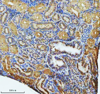 Zebrafish Atp6v1a Antibody Kidney IHC. Immunohistochemical analysis of Atp6v1a protein using Zebrafish Atp6v1a antibody and paraffin-embedded zebrafish kidney tissue. HIER: boil tissue sections in pH8 EDTA for 20 min and allow to cool before testing.