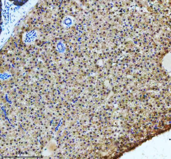 Zebrafish Atp6v1a Antibody Liver IHC. Immunohistochemical analysis of Atp6v1a protein using Zebrafish Atp6v1a antibody and paraffin-embedded zebrafish liver tissue. HIER: boil tissue sections in pH8 EDTA for 20 min and allow to cool before testing.