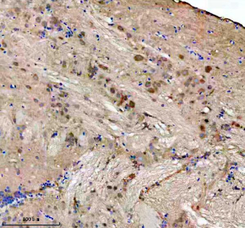 Zebrafish Fhl2 Antibody Brain IHC. Immunohistochemical analysis of FHL2a/b protein using Zebrafish Fhl2 antibody, HRP secondary and DAB substrate with paraffin-embedded zebrafish brain tissue. HIER: boil tissue sections in pH8 EDTA for 20 min and allow to cool before testing.