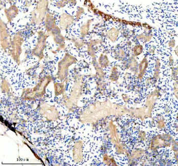 Zebrafish Fhl2 Antibody Kidney IHC. Immunohistochemical analysis of FHL2a/b protein using Zebrafish Fhl2 antibody, HRP secondary and DAB substrate with paraffin-embedded zebrafish kidney tissue. HIER: boil tissue sections in pH8 EDTA for 20 min and allow to cool before testing.