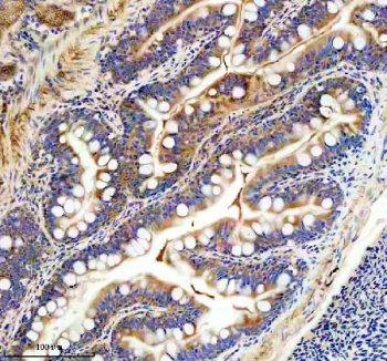 Zebrafish Fhl2 Antibody Colon IHC. Immunohistochemical analysis of FHL2a/b protein using Zebrafish Fhl2 antibody, HRP secondary and DAB substrate with paraffin-embedded zebrafish colon tissue. HIER: boil tissue sections in pH8 EDTA for 20 min and allow to cool before testing.