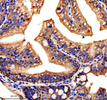 Zebrafish Hook3 Antibody Colon Tissue IHC. Immunohistochemical analysis of Hook3 protein using Zebrafish Hook3 antibody and paraffin-embedded zebrafish colon tissue. HIER: boil tissue sections in pH8 EDTA for 20 min and allow to cool before testing.