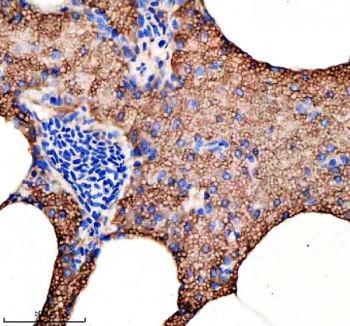 Zebrafish Hook3 Antibody Pancreas Tissue IHC. Immunohistochemical analysis of Hook3 protein using Zebrafish Hook3 antibody and paraffin-embedded zebrafish pancreas tissue. HIER: boil tissue sections in pH8 EDTA for 20 min and allow to cool before testing.