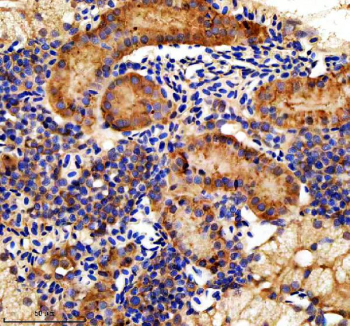 Zebrafish Hook3 Antibody Kidney Tissue IHC. Immunohistochemical analysis of Hook3 protein using Zebrafish Hook3 antibody and paraffin-embedded zebrafish kidney tissue. HIER: boil tissue sections in pH8 EDTA for 20 min and allow to cool before testing.