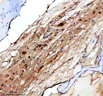 Zebrafish Hs2st1 Antibody Spinal Cord Tissue IHC. Immunohistochemical analysis of Hs2st1a/b protein using Zebrafish Hs2st1 antibody and paraffin-embedded zebrafish spinal cord tissue. HIER: boil tissue sections in pH8 EDTA for 20 min and allow to cool before testing.