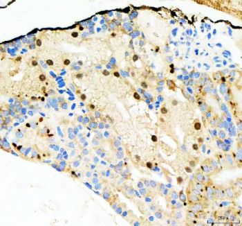 Zebrafish Nol10 Antibody Kidney Tissue IHC - Nucleolar Organization. Immunohistochemical analysis of Nol10 protein using Zebrafish Nol10 antibody, HRP secondary and DAB substrate with paraffin-embedded zebrafish kidney tissue. HIER: boil tissue sections in pH8 EDTA for 20 min and allow to cool before testing.