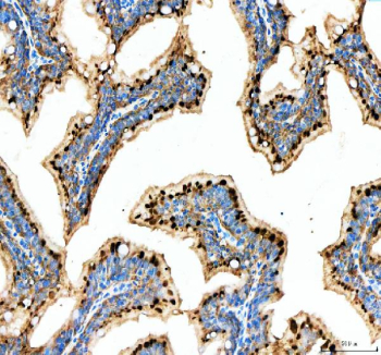Zebrafish Mettl3 Antibody Colon Tissue IHC. Immunohistochemistry staining of Mettl3 protein using Zebrafish Mettl3 antibody, HRP secondary and DAB substrate with zebrafish colon tissue lysate. HIER: boil tissue sections in pH8 EDTA for 20 min and allow to cool before testing.