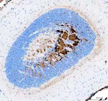 Zebrafish ATP binding cassette E1 / Abce1 Antibody Brain Tissue IHC. Immunohistochemistry staining of FFPE zebrafish brain tissue with Zebrafish ATP binding cassette E1 antibody, HRP-secondary and DAB substrate. HIER: boil tissue sections in pH8 EDTA for 20 min and allow to cool before testing.
