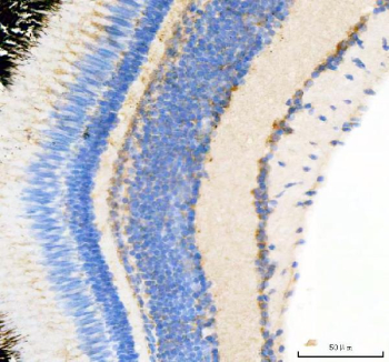 Zebrafish ATP binding cassette E1 / Abce1 Antibody Eye Tissue IHC. Immunohistochemistry staining of FFPE zebrafish eye tissue with Zebrafish ATP binding cassette E1 antibody, HRP-secondary and DAB substrate. HIER: boil tissue sections in pH8 EDTA for 20 min and allow to cool before testing.