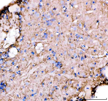 Zebrafish Glutamine synthetase / Glul Antibody Brain Tissue IHC. Immunohistochemical analysis of Glula/b protein using Zebrafish Glutamine synthetase antibody and paraffin-embedded zebrafish brain tissue. HIER: boil tissue sections in pH8 EDTA for 20 min and allow to cool before testing.