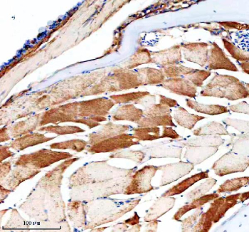 Zebrafish Nampt / Nampt1 Antibody Skeletal Muscle Tissue IHC. Immunohistochemical analysis of Nampt1 protein using Zebrafish Nampt antibody and paraffin-embedded zebrafish skeletal muscle tissue. HIER: boil tissue sections in pH8 EDTA for 20 min and allow to cool before testing.