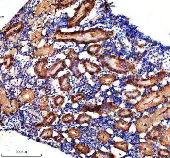 Zebrafish Dlst Antibody Kidney Tissue IHC. Immunohistochemistry staining of FFPE zebrafish kidney tissue with Zebrafish Dlst antibody, HRP secondary and DAB substrate. HIER: boil tissue sections in pH8 EDTA for 20 min and allow to cool before testing.