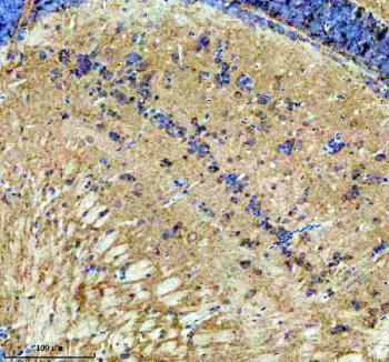 Zebrafish Dlst Antibody Brain Tissue IHC. Immunohistochemistry staining of FFPE zebrafish brain tissue with Zebrafish Dlst antibody, HRP secondary and DAB substrate. HIER: boil tissue sections in pH8 EDTA for 20 min and allow to cool before testing.