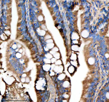 Zebrafish Dlst Antibody Colon Tissue IHC. Immunohistochemistry staining of FFPE zebrafish colon tissue with Zebrafish Dlst antibody, HRP secondary and DAB substrate. HIER: boil tissue sections in pH8 EDTA for 20 min and allow to cool before testing.
