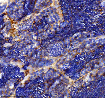 Zebrafish Dlst Antibody Testis Tissue IHC. Immunohistochemistry staining of FFPE zebrafish testis tissue with Zebrafish Dlst antibody, HRP secondary and DAB substrate. HIER: boil tissue sections in pH8 EDTA for 20 min and allow to cool before testing.