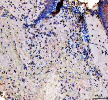 Zebrafish Hmgb1 Antibody Brain Tissue IHC - Ubiquitous Expression. Immunohistochemical analysis of Hmgb1a/b protein using Zebrafish Hmgb1 antibody, HRP secondary and DAB substrate with paraffin-embedded zebrafish brain tissue. HIER: boil tissue sections in pH8 EDTA for 20 min and allow to cool before testing.