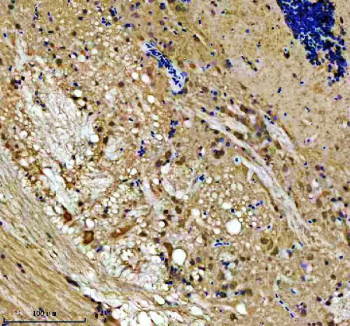 Zebrafish Lsg1 Antibody Brain Tissue IHC. Immunohistochemical analysis of Lsg1 protein using Zebrafish Lsg1 antibody, HPR secondary and DAB substrate with paraffin-embedded zebrafish brain tissue. HIER: boil tissue sections in pH8 EDTA for 20 min and allow to cool before testing.