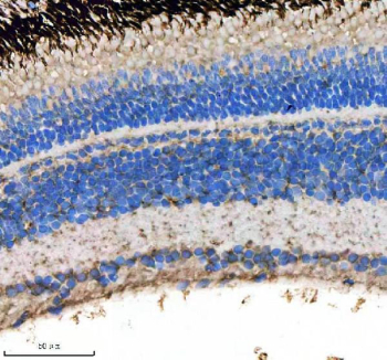 Zebrafish Lsg1 Antibody Eye Tissue IHC. Immunohistochemical analysis of Lsg1 protein using Zebrafish Lsg1 antibody, HPR secondary and DAB substrate with paraffin-embedded zebrafish eye tissue. HIER: boil tissue sections in pH8 EDTA for 20 min and allow to cool before testing.