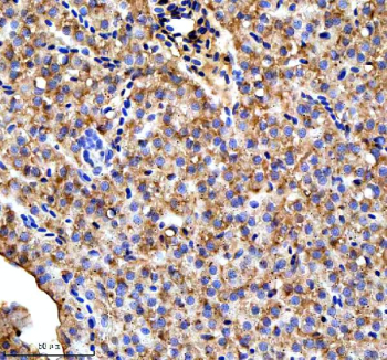 Zebrafish Ttc7b Antibody Liver Tissue IHC. Immunohistochemical analysis of Ttc7b protein using Zebrafish Ttc7b antibody, HRP secondary and DAB substrate with paraffin-embedded zebrafish liver tissue. HIER: boil tissue sections in pH8 EDTA for 20 min and allow to cool before testing.