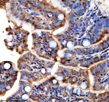 Zebrafish Ttc7b Antibody Colon Tissue IHC. Immunohistochemical analysis of Ttc7b protein using Zebrafish Ttc7b antibody, HRP secondary and DAB substrate with paraffin-embedded zebrafish colon tissue. HIER: boil tissue sections in pH8 EDTA for 20 min and allow to cool before testing.