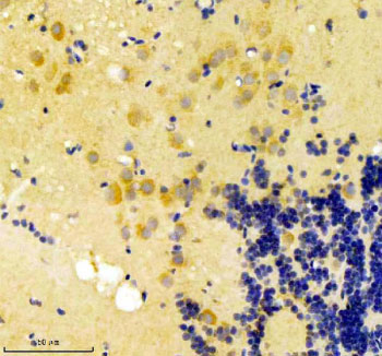 Zebrafish Gnsa Antibody Brain Tissue IHC. Immunohistochemistry staining of FFPE zebrafish brain tissue with Zebrafish Gnsa antibody, HRP secondary and DAB substrate. HIER: boil tissue sections in pH8 EDTA for 20 min and allow to cool before testing.