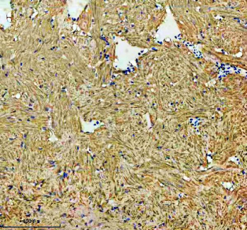Zebrafish Hsp60 Antibody Heart Tissue IHC. Immunohistochemistry staining of FFPE zebrafish heart tissue with Zebrafish Hsp60 antibody, HRP secondary and DAB substrate. HIER: boil tissue sections in pH8 EDTA for 20 min and allow to cool before testing.