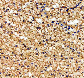 Zebrafish Hsp60 Antibody Liver Tissue IHC. Immunohistochemistry staining of FFPE zebrafish liver tissue with Zebrafish Hsp60 antibody, HRP secondary and DAB substrate. HIER: boil tissue sections in pH8 EDTA for 20 min and allow to cool before testing.