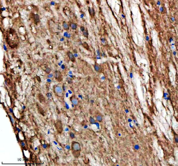 Zebrafish Hsp60 Antibody Spinal Cord Tissue IHC. Immunohistochemistry staining of FFPE zebrafish spinal cord tissue with Zebrafish Hsp60 antibody, HRP secondary and DAB substrate. HIER: boil tissue sections in pH8 EDTA for 20 min and allow to cool before testing.
