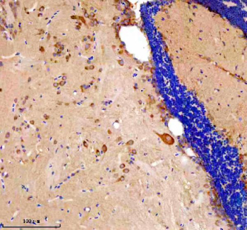 Zebrafish Etf1 Antibody Brain Tissue IHC. Immunohistochemical analysis of Etf1a/b protein using Zebrafish Etf1 antibody and paraffin-embedded zebrafish brain tissue. HIER: boil tissue sections in pH8 EDTA for 20 min and allow to cool before testing.