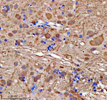 Zebrafish Gmps Antibody Brain Tissue IHC. Immunohistochemical analysis of Gmps protein using Zebrafish Gmps antibody and a paraffin-embedded zebrafish brain tissue. HIER: boil tissue sections in pH8 EDTA for 20 min and allow to cool before testing.