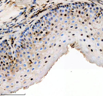 Zebrafish Hmgb2 Antibody Esophagus Tissue IHC. Immunohistochemistry staining of FFPE zebrafish esophagus tissue with Zebrafish Hmgb2 antibody, HRP secondary and DAB substrate. HIER: boil tissue sections in pH8 EDTA for 20 min and allow to cool before testing.