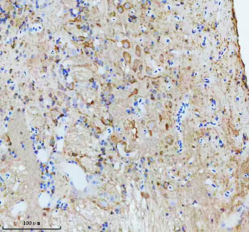 Zebrafish Cct4 Antibody Brain IHC. Immunohistochemistry staining of FFPE zebrafish brain tissue with Zebrafish Cct4 antibody, HRP secondary and DAB substrate. HIER: boil tissue sections in pH8 EDTA for 20 min and allow to cool before testing.