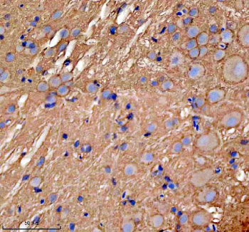 Zebrafish Gnao1a Antibody Brain Tissue IHC. Immunohistochemistry staining of FFPE zebrafish brain tissue with Zebrafish Gnao1a antibody, HRP secondary and DAB substrate. HIER: boil tissue sections in pH8 EDTA for 20 min and allow to cool before testing.