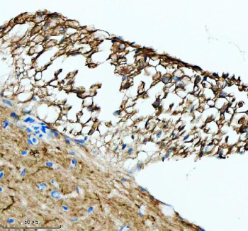 Zebrafish Luteinizing hormone beta / Lhb Antibody Hypophysis IHC. Immunohistochemistry staining of zebrafish Luteinizing hormone beta protein using Zebrafish Luteinizing hormone beta antibody, HRP-labeled secondary and DAB substrate. Luteinizing hormone beta was detected in a paraffin-embedded section of zebrafish hypophysis tissue. HIER: boil tissue sections in pH8 EDTA for 20 min and allow to cool before testing.